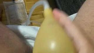 pees in my catheter4